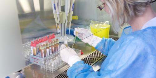 Frau mit Schutzkleidung hält Pipette mit Flüssigkeit in rechter Hand und Röhrchen in linker Hand